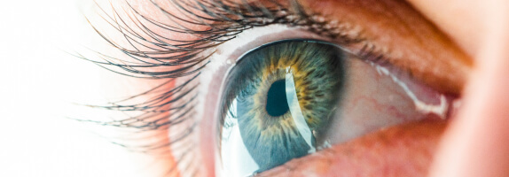 Age-Related Macular Degeneration (AMD) Management