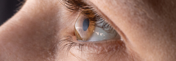 Treating corneal diseases